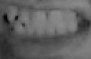 MyTeeth3.jpg