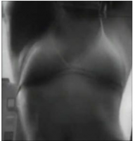 Cherry18bi